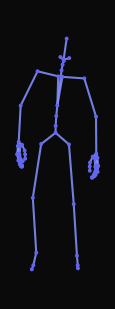 A person standing with an injured right leg starts to walk forward, limping over their right leg at a slow pace, and then comes to a stop.
