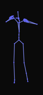 A person starts jogging before stepping on an object and then continues to limp forward in pain. The person stops and stands with a hunched forward posture.