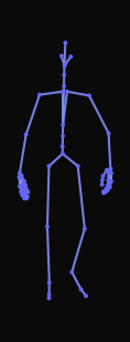 A person limps forward favoring their right leg, wincing with each step
