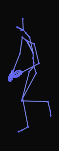 A person walking forward abruptly steps on an object with their right foot and promptly starts jumping in pain before gradually turning to the right and continuing limping forward.